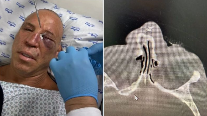 Foto: Reprodução / Redes Sociais