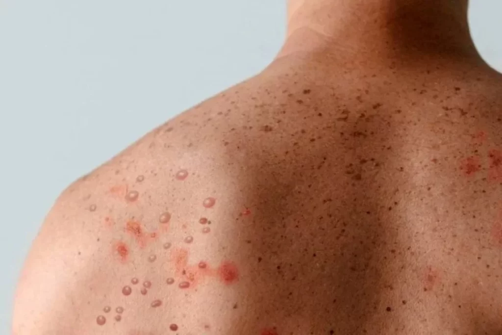 Foto: Reprodução / Acorda Cidade