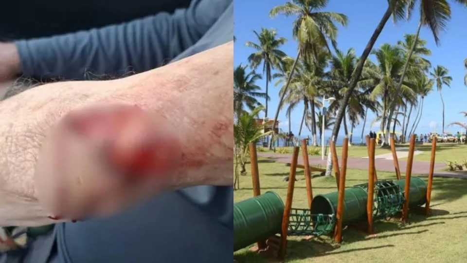 Idoso sofre ataque bruta de pitbull em orla movimentada de Salvador