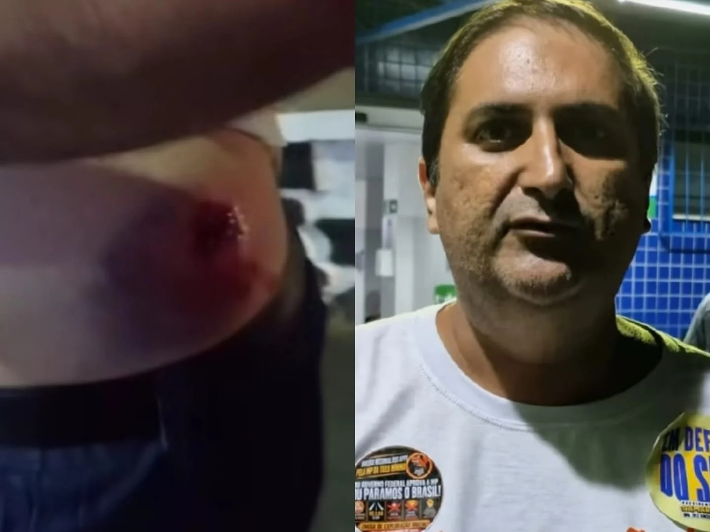 Candidato ao governo da Bahia faz denúncia contra a PM após ter sido atingido por bala de borracha